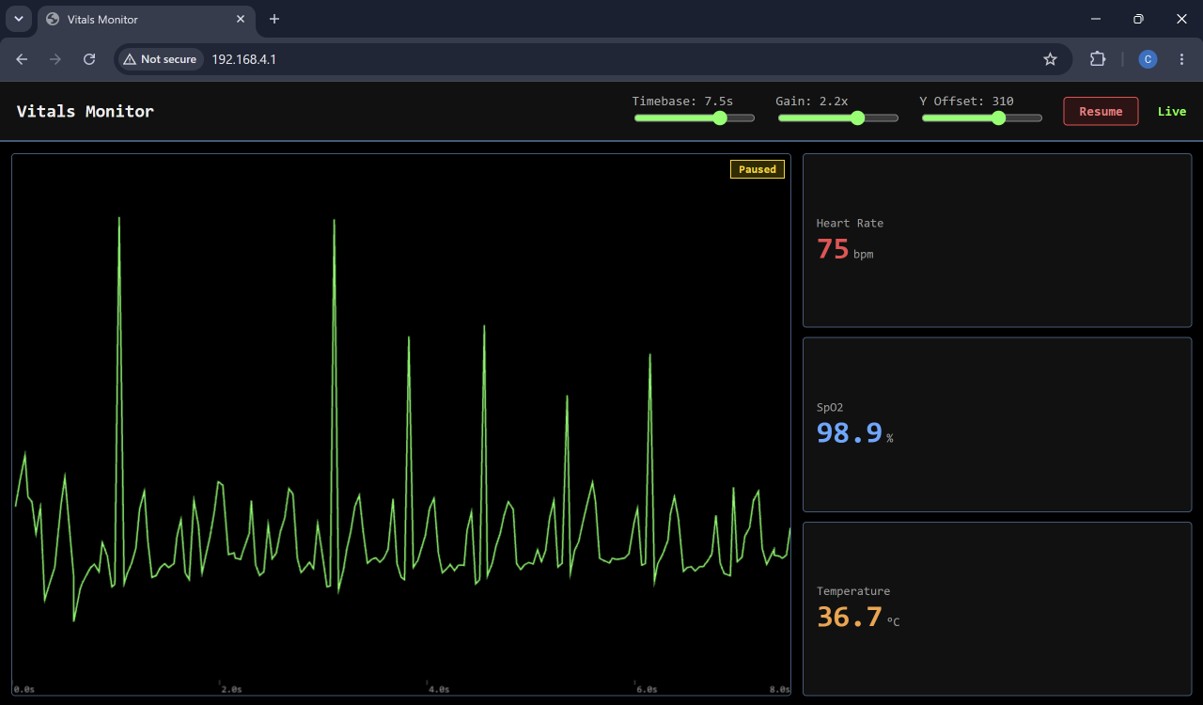 Dashboard at a wider 7.5s timebase showing several beats in a row