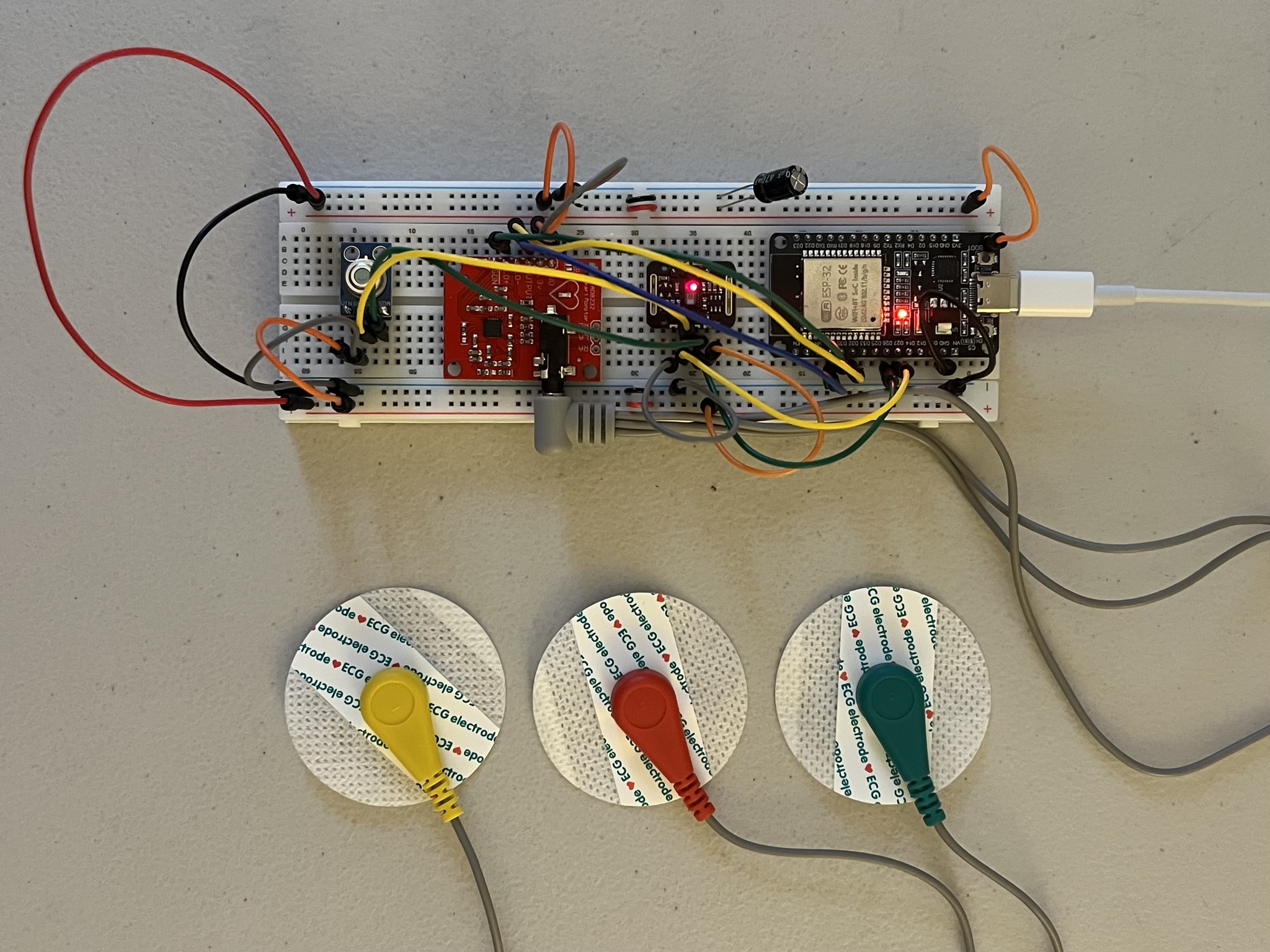 ESP32 Vitals Monitor